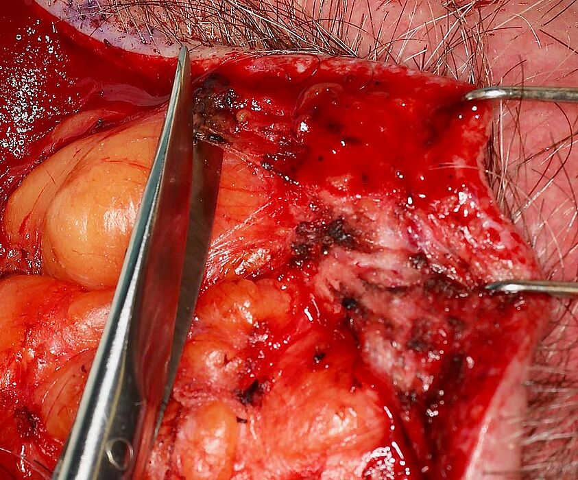Tissue exposure